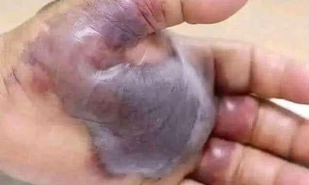 ATTENTION to these first signs of...See More