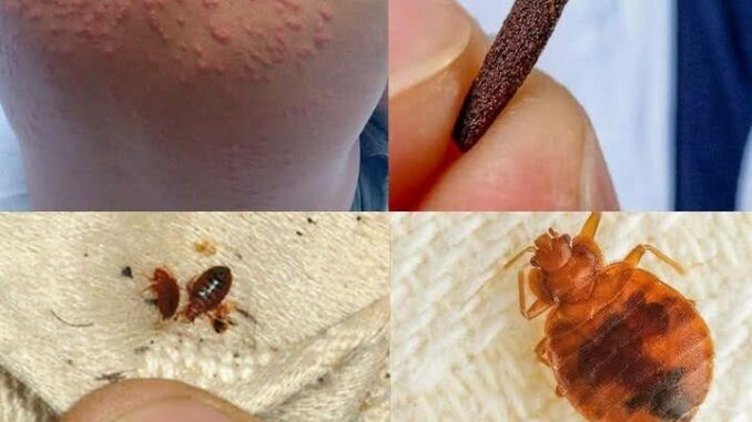 Bedbug How does it live How to eradicate it from the house