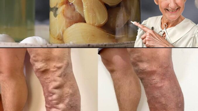 “Many Use Garlic at Night for Healthy Legs – See How It Works”