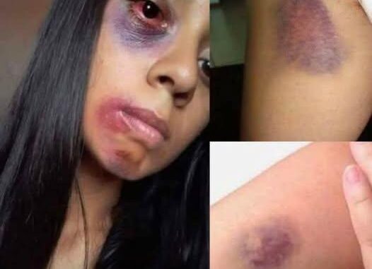 Young woman dies at the hands of her…See more
