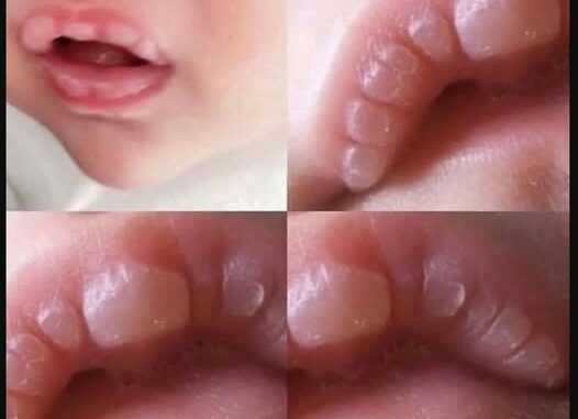 If your baby has these marks it means... See more