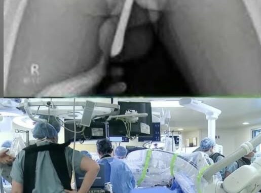 😱😢Girl had to be hospitalized for wanting to use a pe...See moree